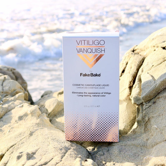 Loving the Skin You're In with Vitiligo Vanquish