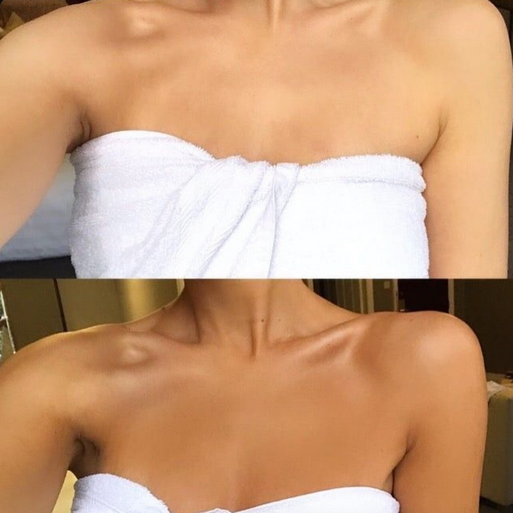 Transform Your Look: Stunning Before-and-After Self-Tanning Results